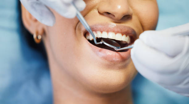 Best Urgent Tooth Repair  in Overton, TX